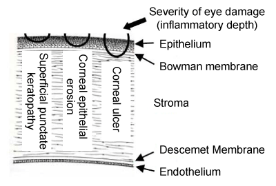 Picture showing structure of cornea and inflammatory depth of three common types of eye damage