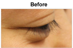 photo of eyelashes before the eyelash extension procedure
